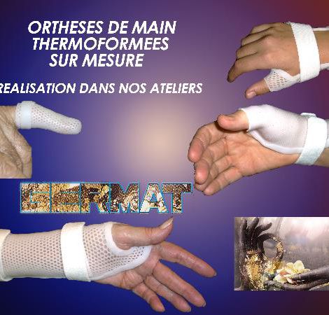 ORTHESE DE MAIN SUR MESURE